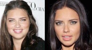Take a look at the shocking celebrity Adriana Lima Plastic Surgery before a...