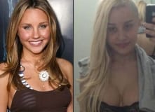 Amanda Bynes Plastic Surgery Photo Before and After