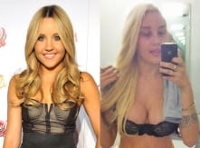 Amanda Bynes Plastic Surgery Photo Before and After