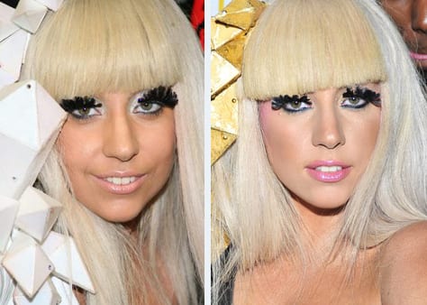 Celebrity Lady Gaga Before And After Nose Job : CELEB-SURGERY.COM