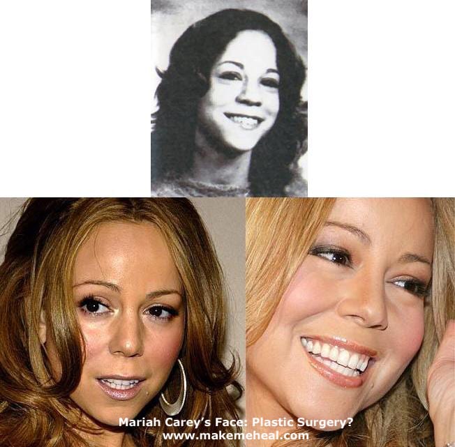 Celebrity Mariah Carey Facial Plastic Surgery Before And