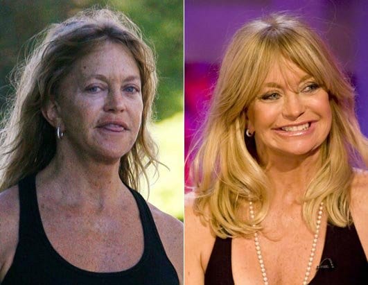 Celebrity Goldiessh Plastic Surgery Before And After 