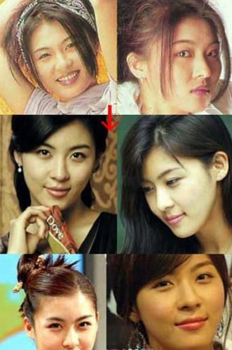Celebrity Ha Ji Won From Secret Garden Plastic Surgery Before And After