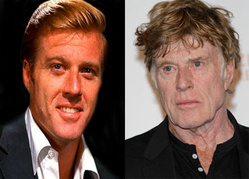 Robert Redford Plastic Surgery Before After - CELEB-SURGERY.COM