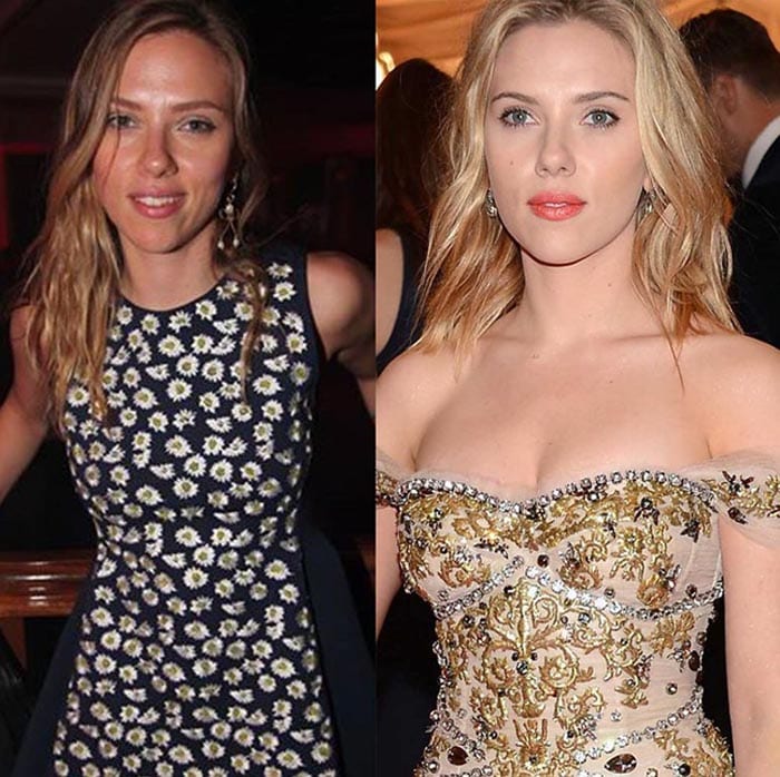 Scarlett Johansson Breast Implants Removed - CELEB-SURGERY.COM.