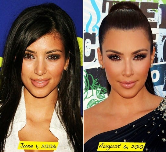 Kim Kardashian Plastic Surgery Before After Picture Celeb Surgerycom