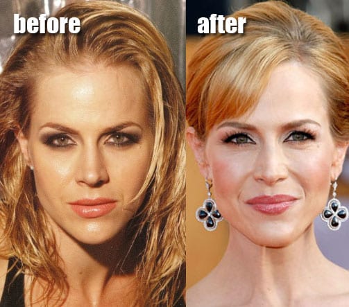 julie benz before and after implants