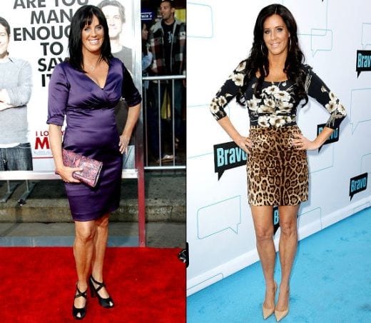 Celeb Surgery Patti Stanger Plastic Surgery Before and After - CELEB ...