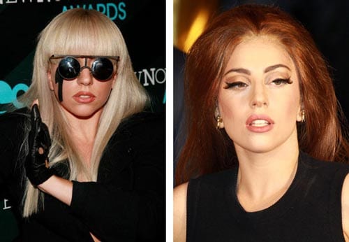Celebrity Lady Gaga Nose Job Before After - CELEB-SURGERY.COM