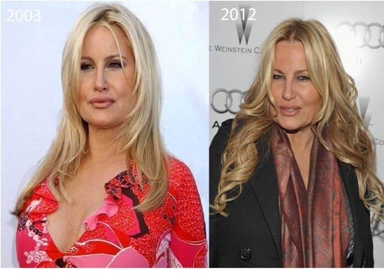 Jennifer Coolidge Plastic Surgery Before and After - CELEB-SURGERY.COM.