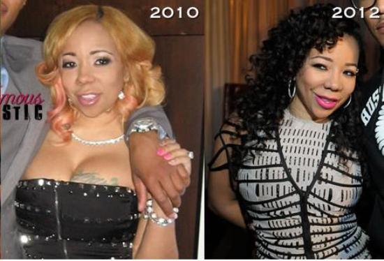 Tiny Cottle Plastic Surgery Before and After - CELEB ...