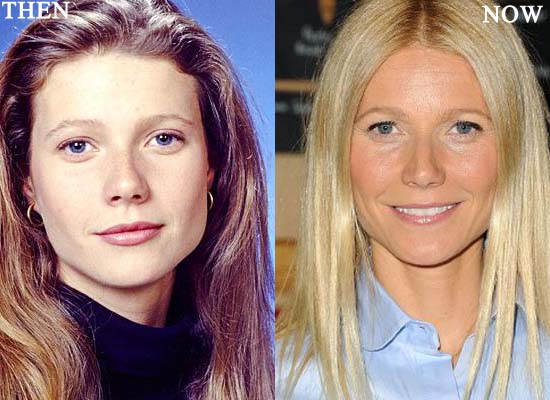 Gwyneth Paltrow Plastic Surgery Photo Before And After Celeb Surgery