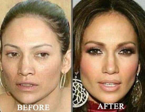 Jennifer Lopez Nose Job Photo Before And After Celeb Surgerycom