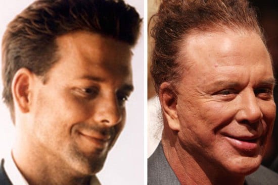 Mickey Rourke Plastic Surgery Photo Before and After : CELEB-SURGERY.COM